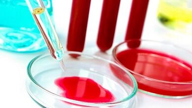 Blood tests for parasites