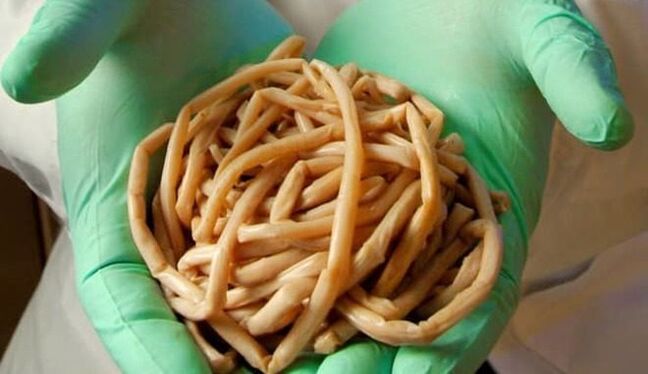 removes parasites from the body
