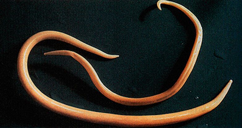 parasitic worms from the human body
